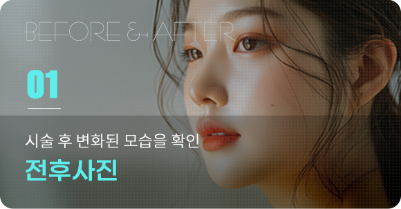 전후사진